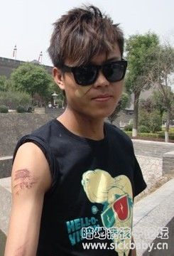 我被摔了，浑身是伤。